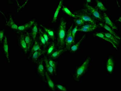 Polyclonal Rabbit anti-Human PPP2R4 Antibody (IHC, WB)
