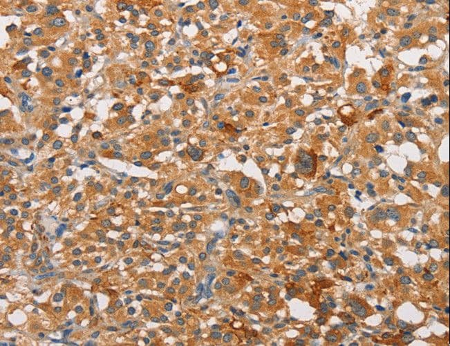 Polyclonal Rabbit anti-Human PRKCE / PKC-Epsilon Antibody (IHC)