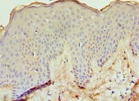 Polyclonal Rabbit anti-Human ECE-1 Antibody (aa471-770, IHC)