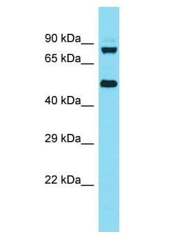 KBTBD6 Antibody (aa2-51)