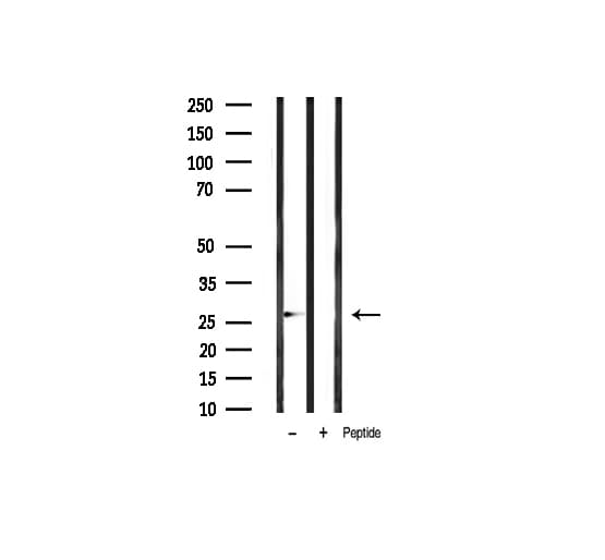 BCL2 / Bcl-2 Antibody (phospho-Thr69)