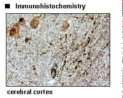 SLC6A4 / SERT Antibody