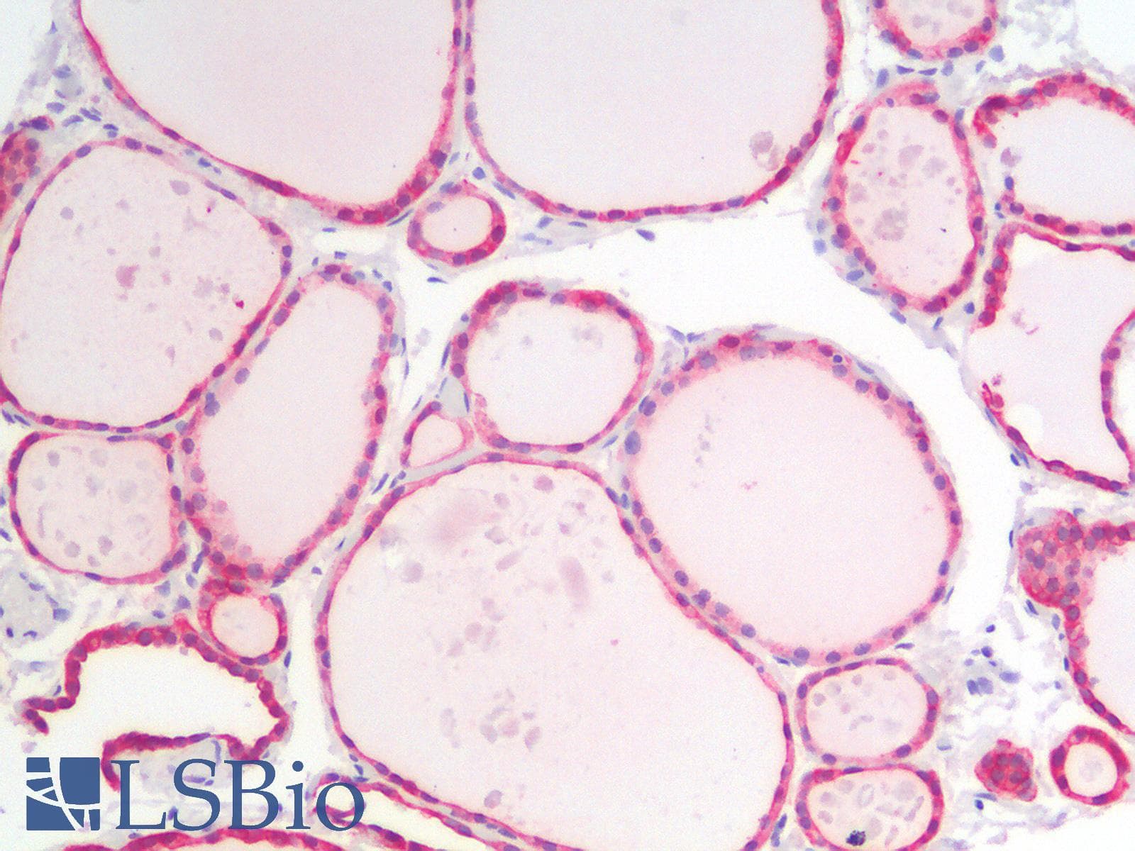 PathPlus™ KRT18 / CK18 / Cytokeratin 18 Antibody