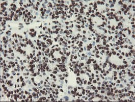 NONO / P54NRB Antibody (aa184-385, clone OTI5F1)