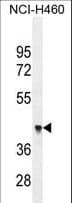 FOXD4L1 / FOXD5 Antibody (aa1-30)