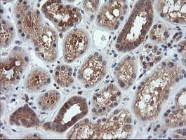 MAP2K1 / MKK1 / MEK1 Antibody (clone OTI4E1)