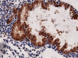 AK5 / Adenylate Kinase 5 Antibody (clone OTI2F9)
