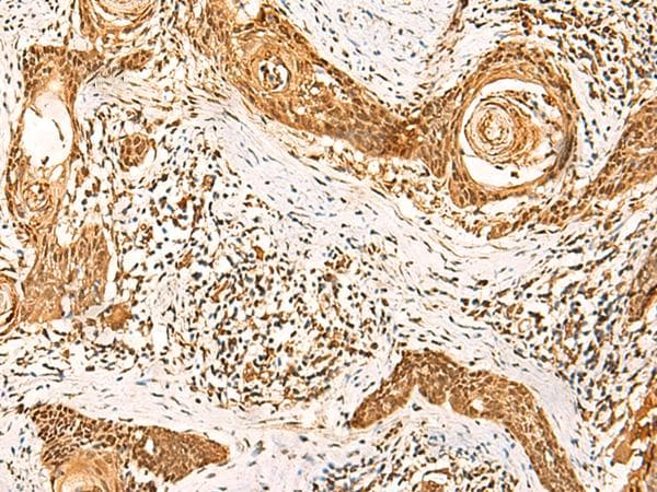 GSG1L Antibody
