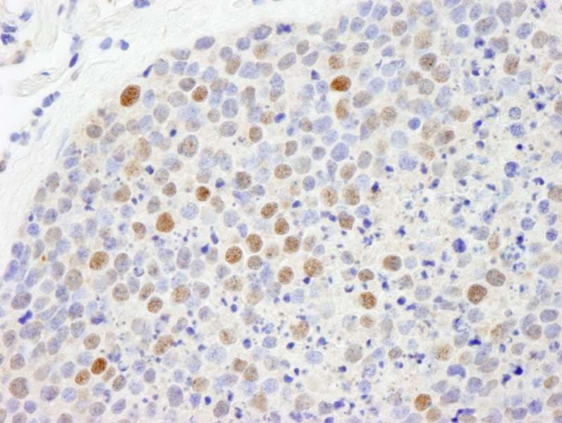 CBX5 / HP1 Alpha Antibody (aa150-C-term)
