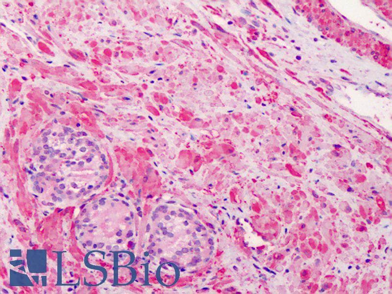IHC-plus™ VCL / Vinculin Antibody (Azide-free)