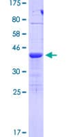 Human TIAF1 Protein (Recombinant GST)
