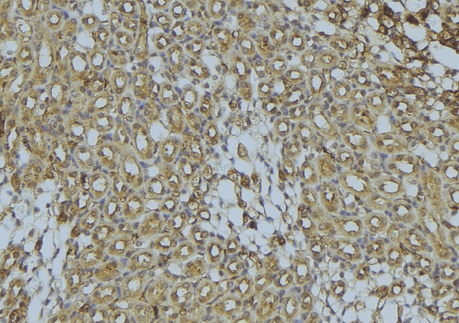 Polyclonal Rabbit anti-Human SCAD / ACADS Antibody (IHC, WB)