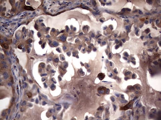 MMP7 / Matrilysin Antibody (aa95-267, clone OTI3G7)