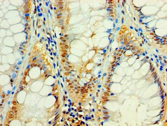 C4orf3 Antibody (aa1-44)
