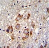 ANKRD34B Antibody (aa467-495)