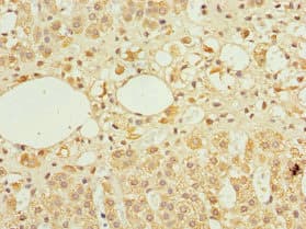 Polyclonal Rabbit anti-Human TFCP2 / CP2 Antibody (IHC, WB)