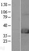 FAM70A Protein (Over-Expression Lysate Myc-DDK (Flag))