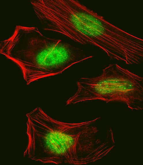 SUMO1 / SMT3 Antibody