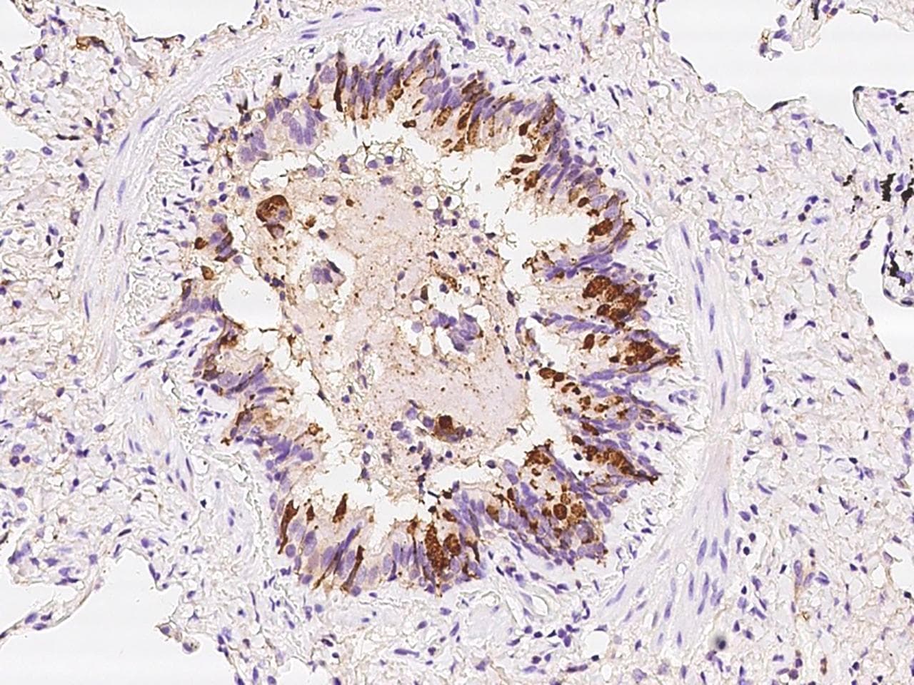 SCGB1A1 / Uteroglobin Antibody (Preservative Free)