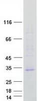 Human TMEM176A / HCA112 Protein (Recombinant Myc-DDK (Flag))