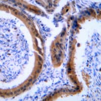 Polyclonal Rabbit anti-Human VASP Antibody (Internal, IHC, IF, WB)