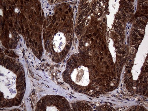 TSN / Translin Antibody (aa1-51, clone OTI1B5)