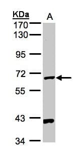 Polyclonal Rabbit anti-Human PANK1 / PANK Antibody (aa207-513, IHC, WB)