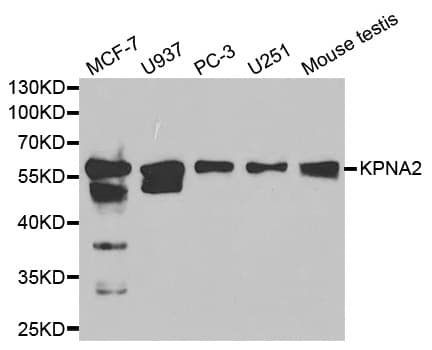 IHC-plus™ KPNA2 / Importin Alpha 1 Antibody