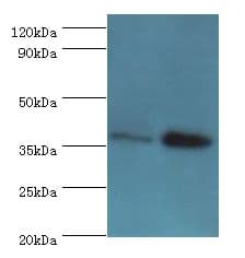Polyclonal Rabbit anti-Human CTSK / Cathepsin K Antibody (aa115-329, IHC, WB)