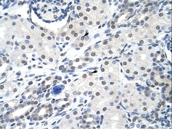 SNRPA / U1A Antibody (aa191-240, FITC)