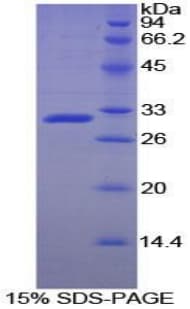 Rat ACP5 / TRAP Protein (Recombinant His)