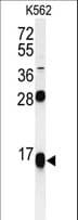 RPS15A Antibody (aa1-30)