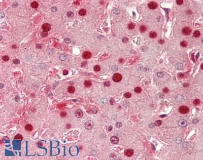 IHC-plus™ Monoclonal Mouse anti-Human TKT / Transketolase Antibody (clone 5H3, IHC, IF, WB)