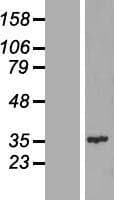 CENPQ Protein (Over-Expression Lysate Myc-DDK (Flag))