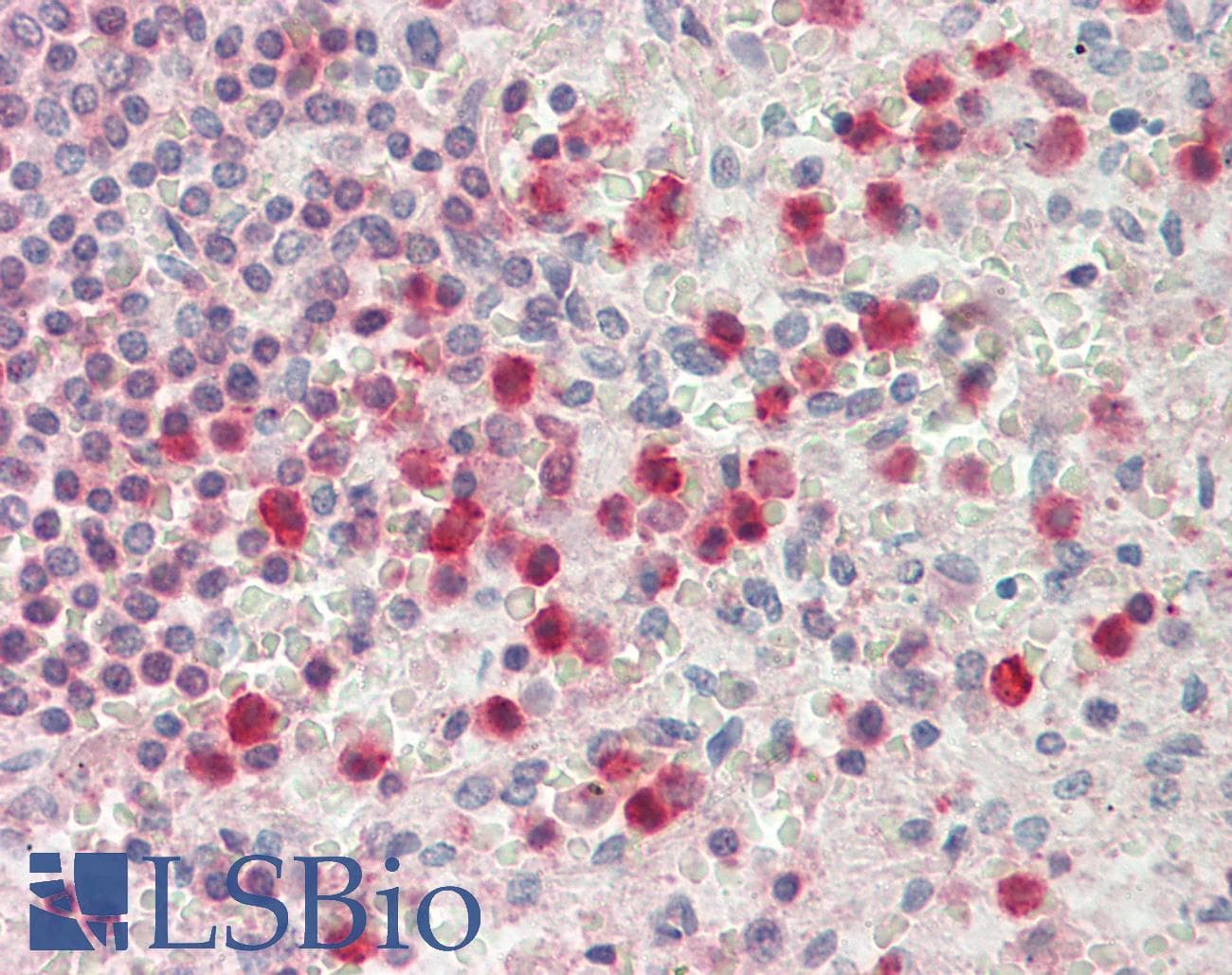 IHC-plus™ Polyclonal Goat anti-Human SERPINB1 Antibody (aa130-143, IHC, WB)