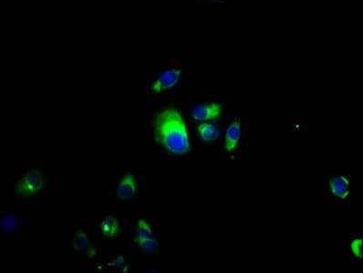 CSF2RB / CD131 Antibody