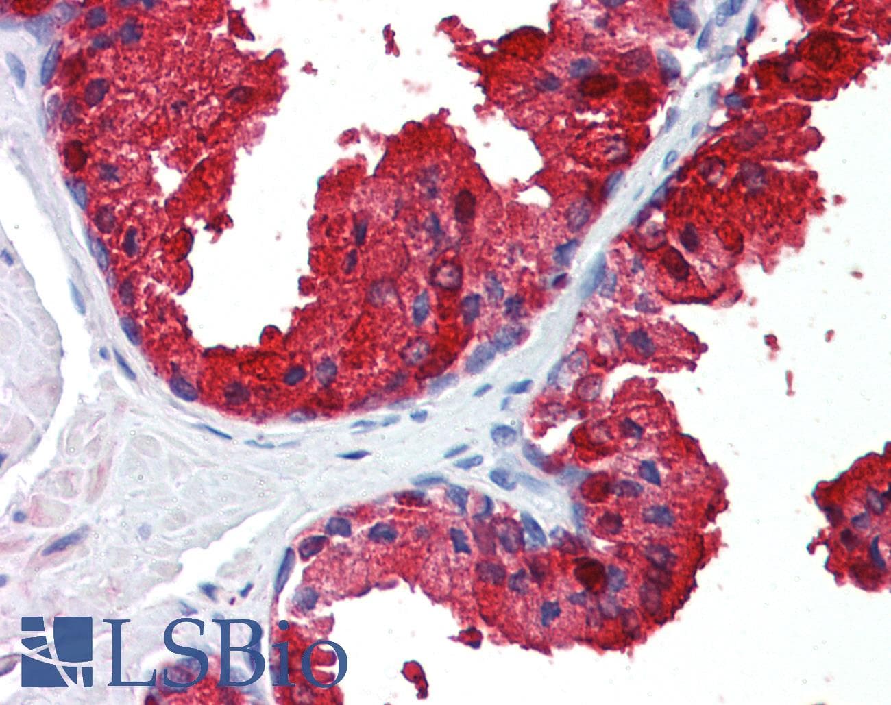 IHC-plus™ Polyclonal Goat anti-Human SORD / Sorbitol Dehydrogenase Antibody (aa345-357, IHC, WB)