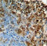 ITPA Antibody (aa24-51)