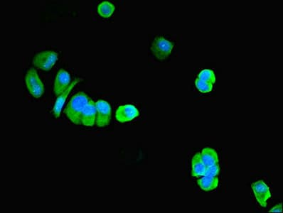 Polyclonal Rabbit anti-Human PNPLA1 Antibody