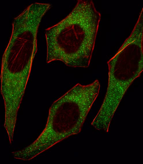 IRS2 / IRS-2 Antibody (aa1309-1338)