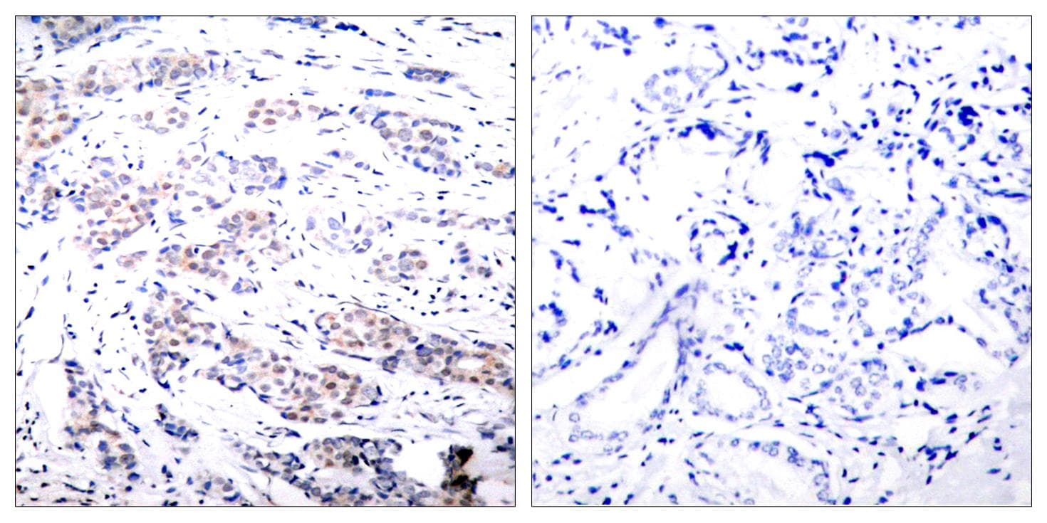 Polyclonal Rabbit anti-Human ELK1 Antibody (p383, IHC, IF, WB)
