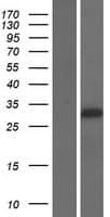 FOXI2 Protein (Over-Expression Lysate Myc-DDK (Flag))