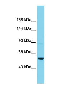Polyclonal Rabbit anti-Human AGAP11 Antibody (aa451-500, WB)