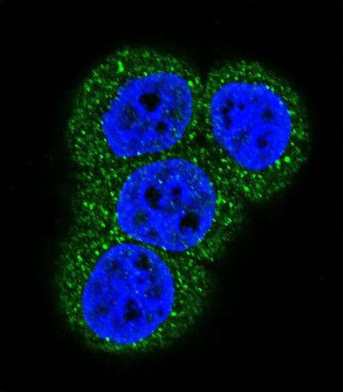 ACTC1 / Alpha Cardiac Actin Antibody (aa38-67)