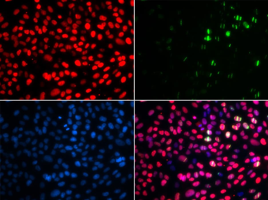 Polyclonal Rabbit anti-Human MSH6 Antibody (IHC, IF, WB)