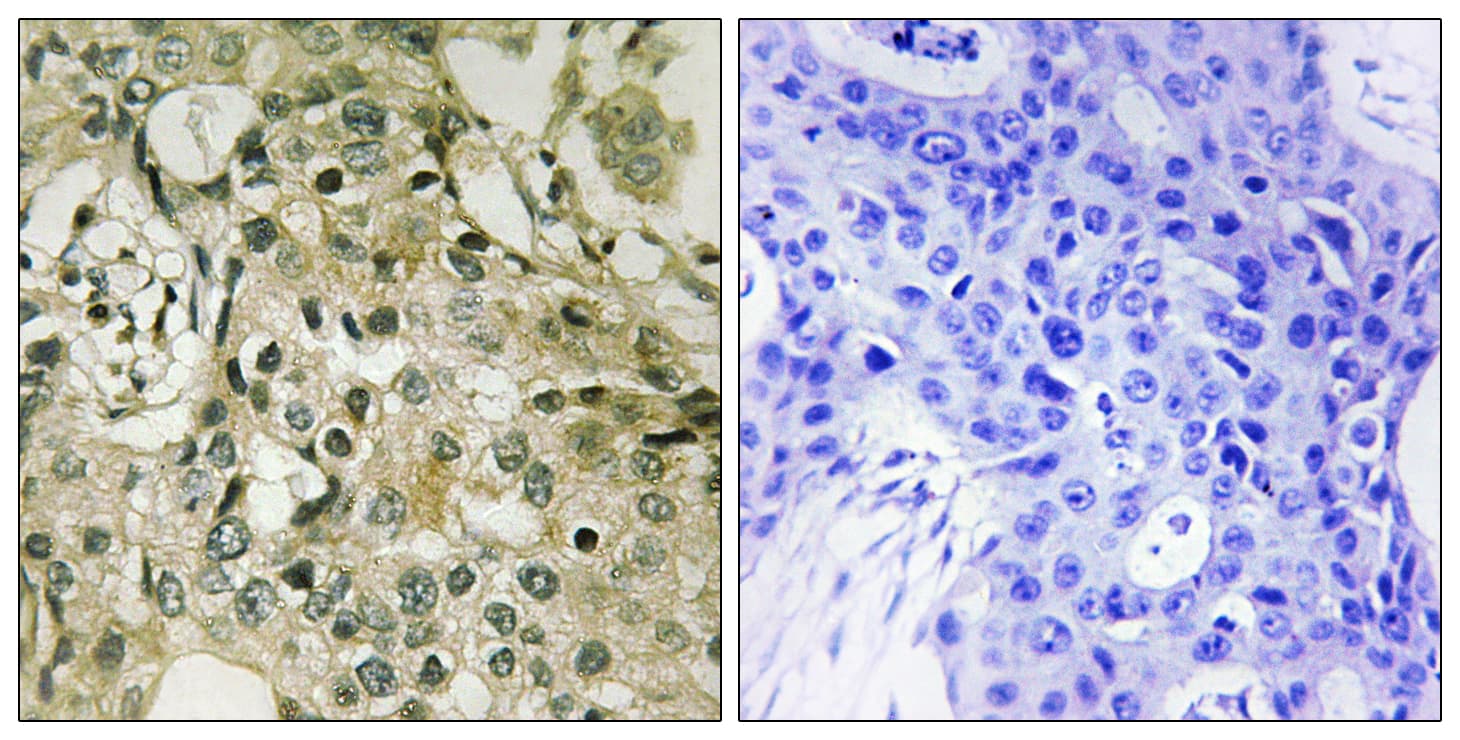 Polyclonal Rabbit anti-Human Thymidylate Kinase Antibody (aa1-50, IHC, WB)