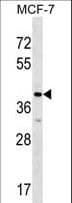 BM022 / MRPL1 Antibody (aa70-97)