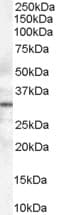 STX6 / Syntaxin 6 Antibody (aa112-122)