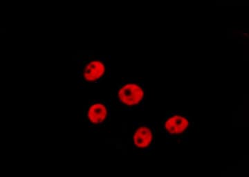 CCND3 / Cyclin D3 Antibody