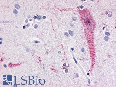 PathPlus™ Polyclonal Rabbit anti-Human TAAR6 Antibody (C-Terminus, IHC)